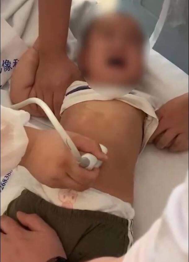全网愤怒！误将IM电竞 电子竞技平台5厘米长针掉进小孩胃中家长讨说法反遭嘲讽(图3)